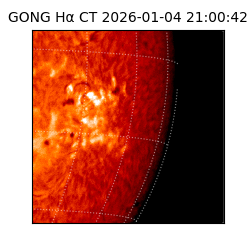 gong - 2026-01-04T21:00:42