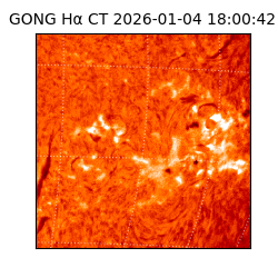 gong - 2026-01-04T18:00:42