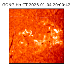 gong - 2026-01-04T20:00:42