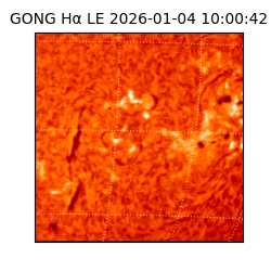 gong - 2026-01-04T10:00:42