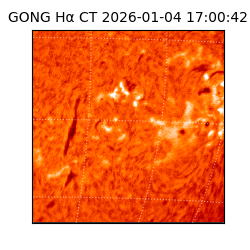 gong - 2026-01-04T17:00:42