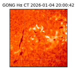 gong - 2026-01-04T20:00:42