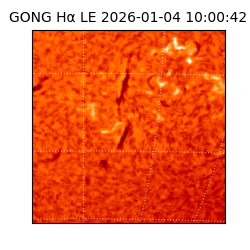 gong - 2026-01-04T10:00:42