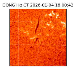 gong - 2026-01-04T18:00:42
