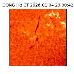 gong - 2026-01-04T20:00:42