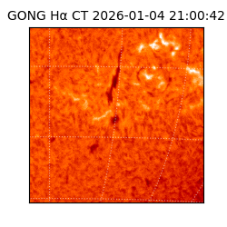gong - 2026-01-04T21:00:42