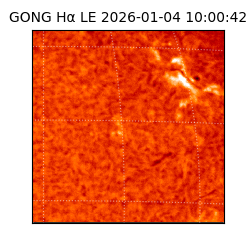 gong - 2026-01-04T10:00:42