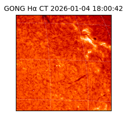 gong - 2026-01-04T18:00:42