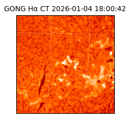 gong - 2026-01-04T18:00:42