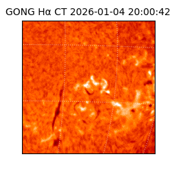 gong - 2026-01-04T20:00:42