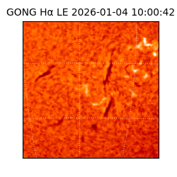gong - 2026-01-04T10:00:42