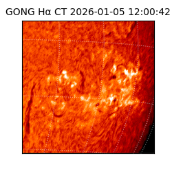 gong - 2026-01-05T12:00:42