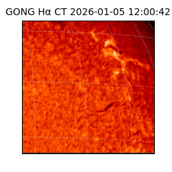 gong - 2026-01-05T12:00:42