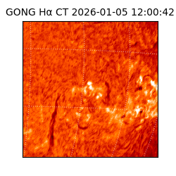 gong - 2026-01-05T12:00:42