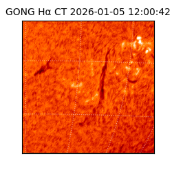 gong - 2026-01-05T12:00:42