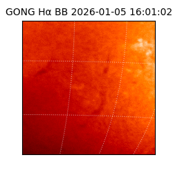 gong - 2026-01-05T16:01:02