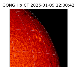 gong - 2026-01-09T12:00:42