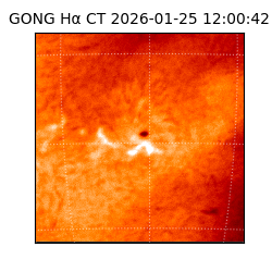 gong - 2026-01-25T12:00:42