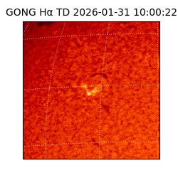 gong - 2026-01-31T10:00:22