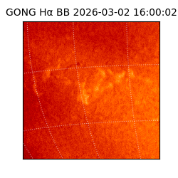 gong - 2026-03-02T16:00:02