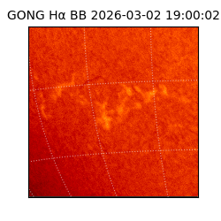 gong - 2026-03-02T19:00:02