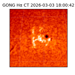 gong - 2026-03-03T18:00:42