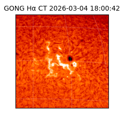 gong - 2026-03-04T18:00:42