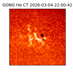 gong - 2026-03-04T22:00:42
