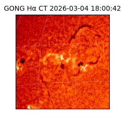 gong - 2026-03-04T18:00:42