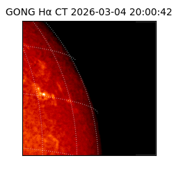 gong - 2026-03-04T20:00:42