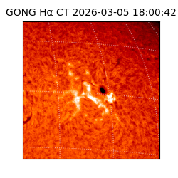 gong - 2026-03-05T18:00:42