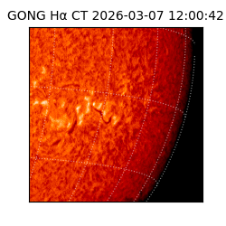 gong - 2026-03-07T12:00:42
