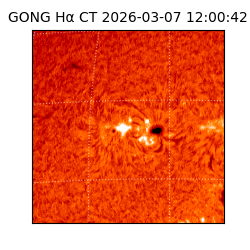 gong - 2026-03-07T12:00:42