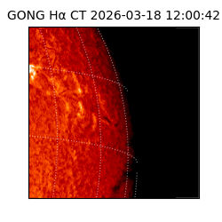 gong - 2026-03-18T12:00:42