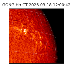 gong - 2026-03-18T12:00:42