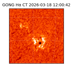 gong - 2026-03-18T12:00:42