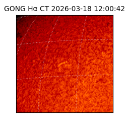 gong - 2026-03-18T12:00:42