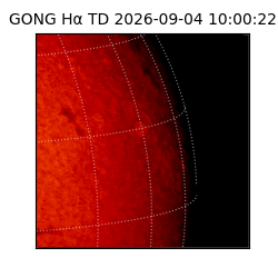 gong - 2026-09-04T10:00:22